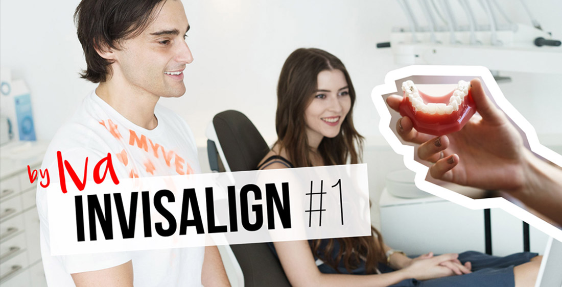 INVISALIGN REVIEW - everything you need to know 